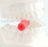 ALIGNER CHEWIES - - alt view 1