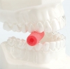 ALIGNER CHEWIES - - alt view 2
