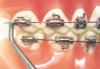 DYNAFLEX DISTAL BENDER - - alt view 1