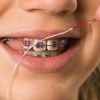 STURDYFLOSS - - alt view 2