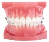 CLEARVIZ+ .022 RX ROTH <BR> 5 PACK - - alt view 2