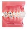 CLEARVIZ+ .022 RX ROTH <BR> 5 PACK - - alt view 3