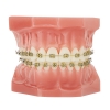 ATLAS MINI BRIGHT GOLD <BR>BRACKET SYSTEM - - alt view 4