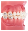 CLEARVIZ+ MINI <BR>BRACKET SYSTEM - - alt view 5