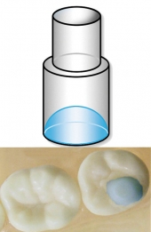 MINI MOLDS MOLAR PAD