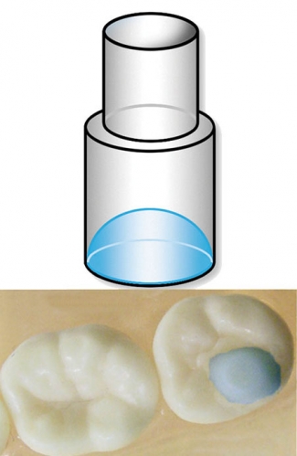 MINI MOLDS MOLAR PAD