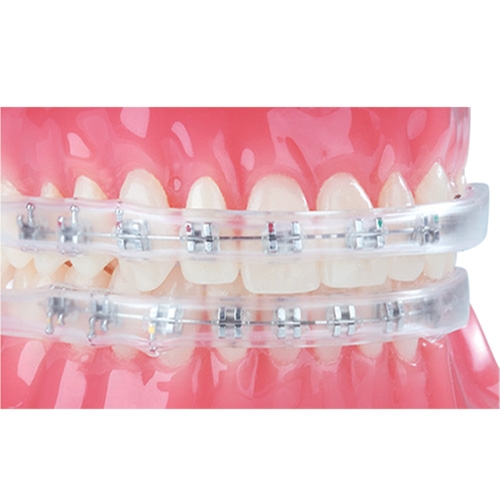 COMFORT COVERS FOR ORTHODONTIC BRACES