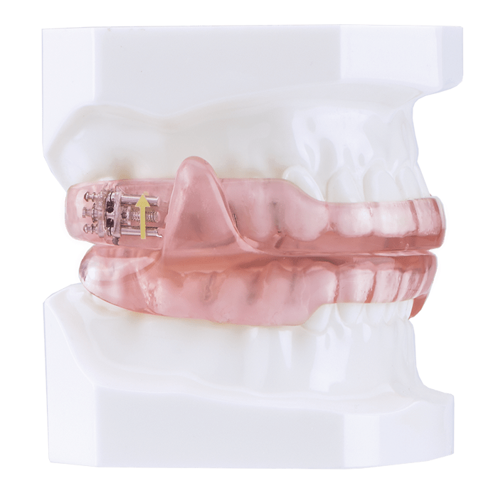 Dental Sleep Devices - DynaFlex Sleep Lab
