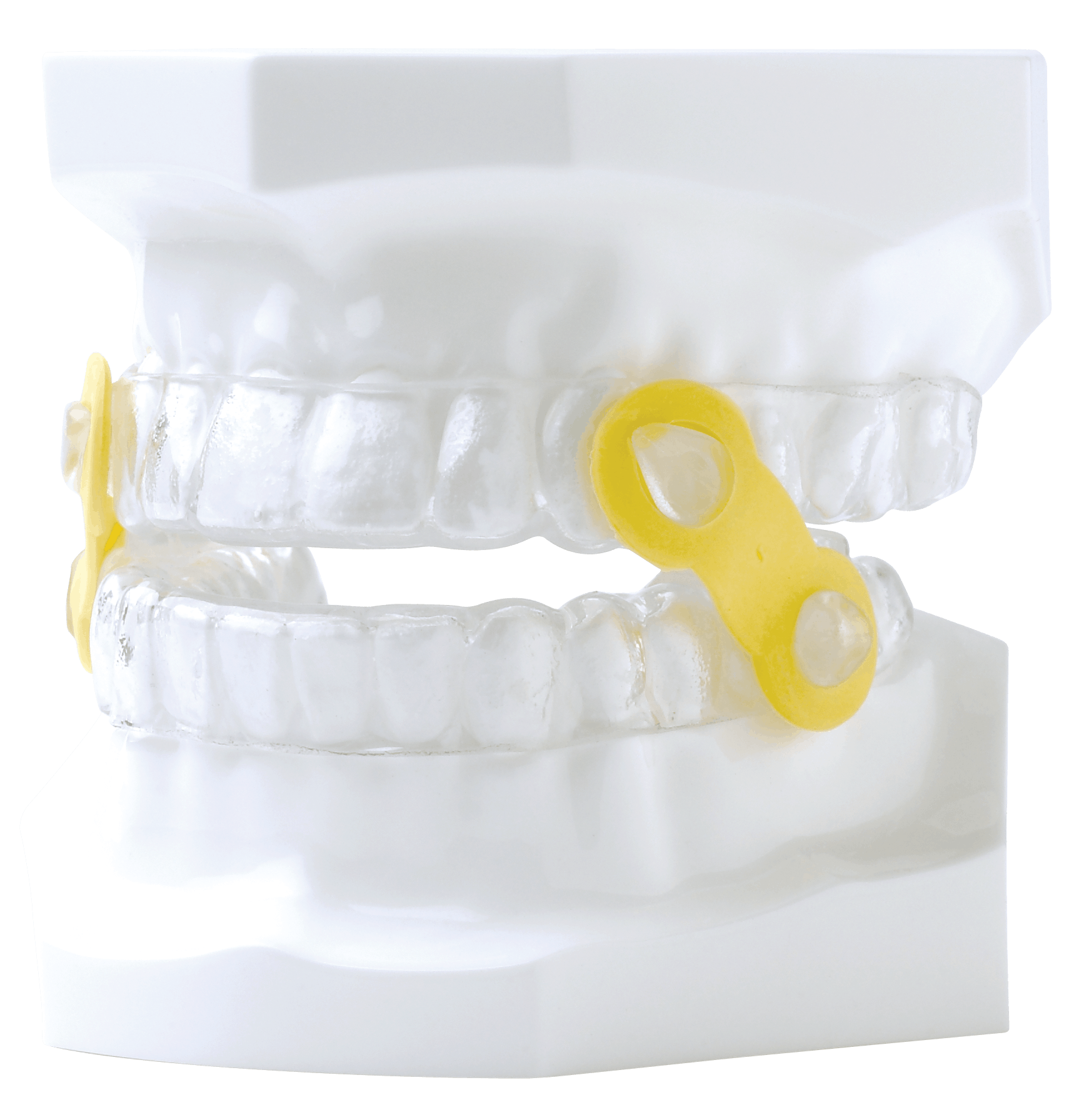 Elastic Mandibular Advancement (EMA) Appliance DynaFlex