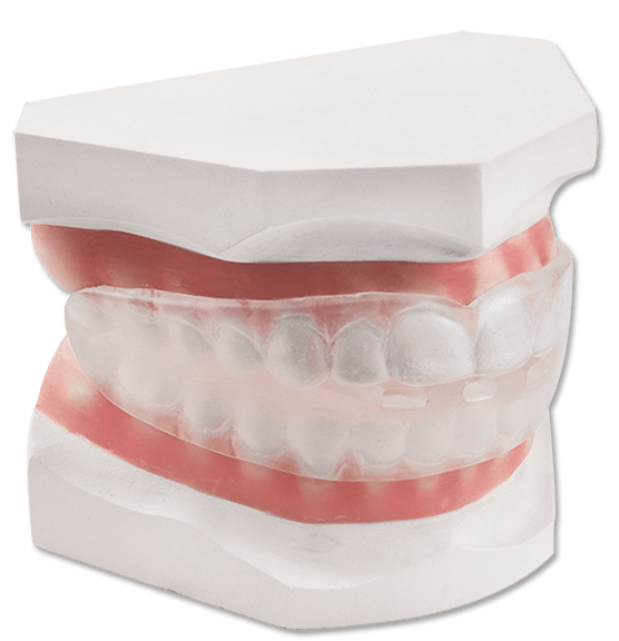 Removable Appliances DynaFlex