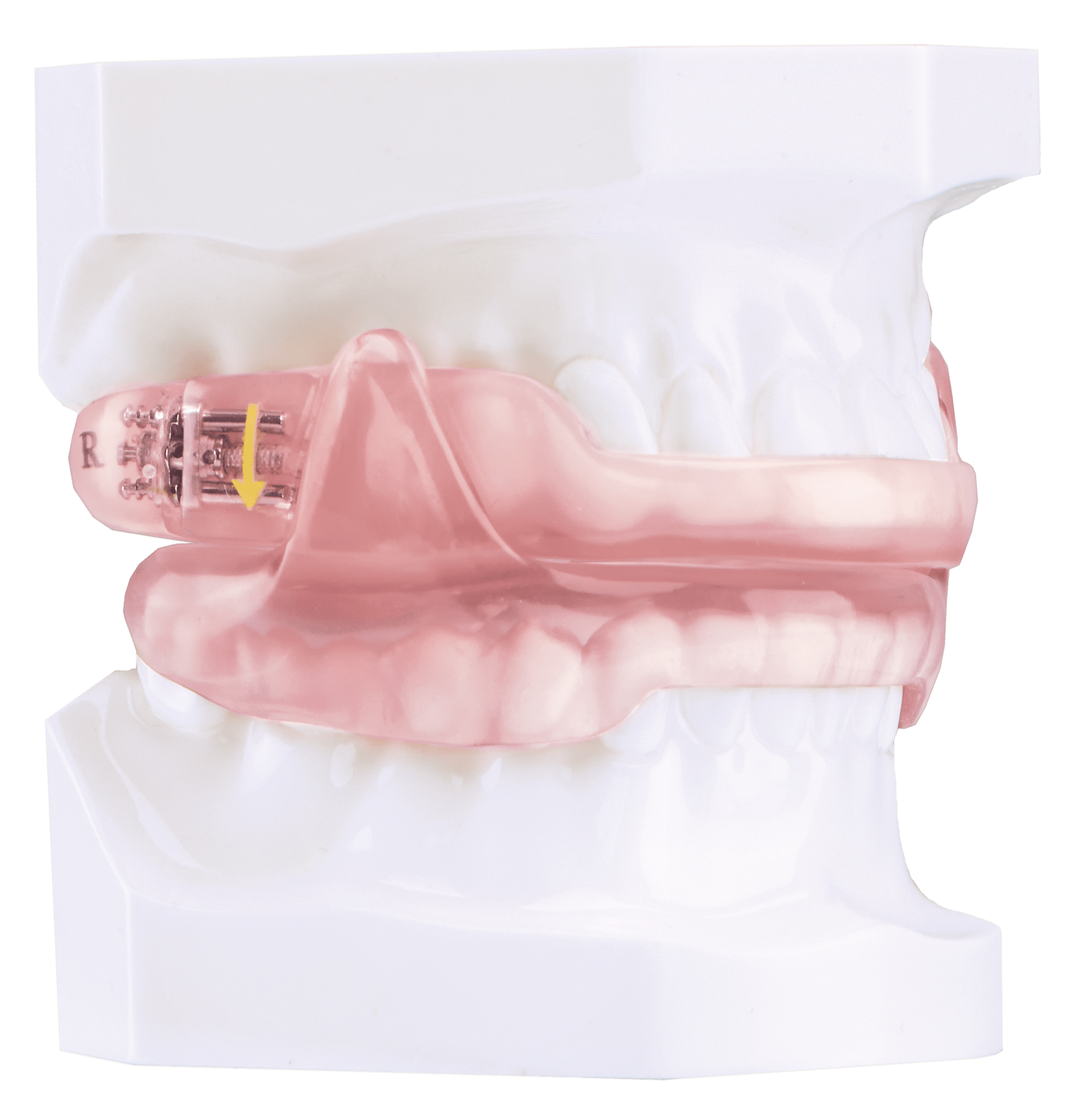 DynaFlex Dorsal DynaFlex