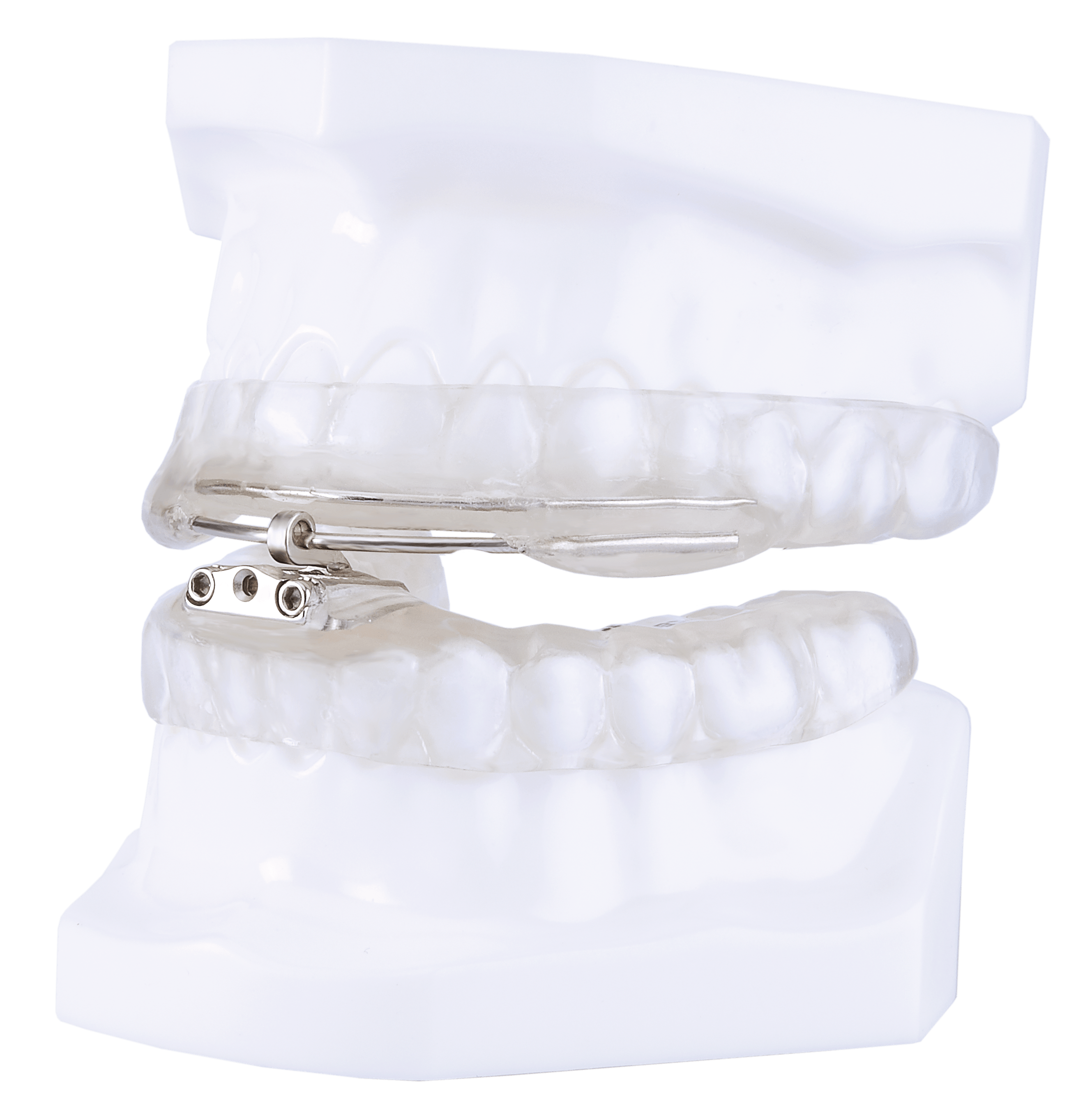 Thorton Adjustable Position (TAP) Devices DynaFlex